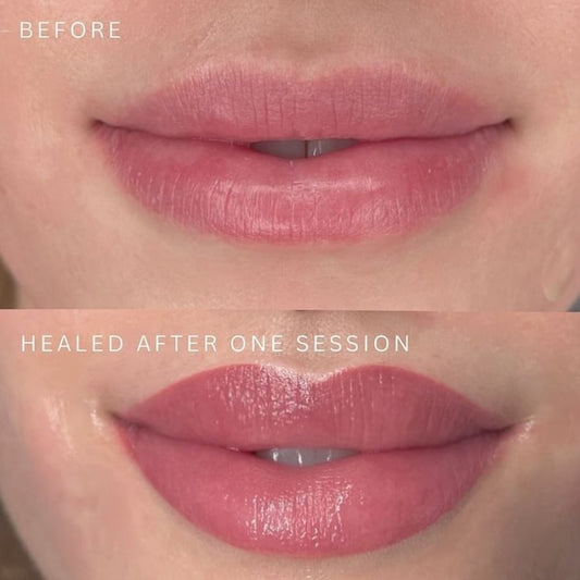 lip retouch